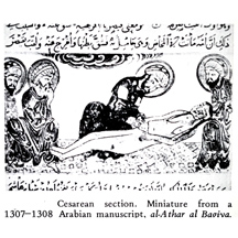 1307-Cesarean-Athar-al-Bagiva