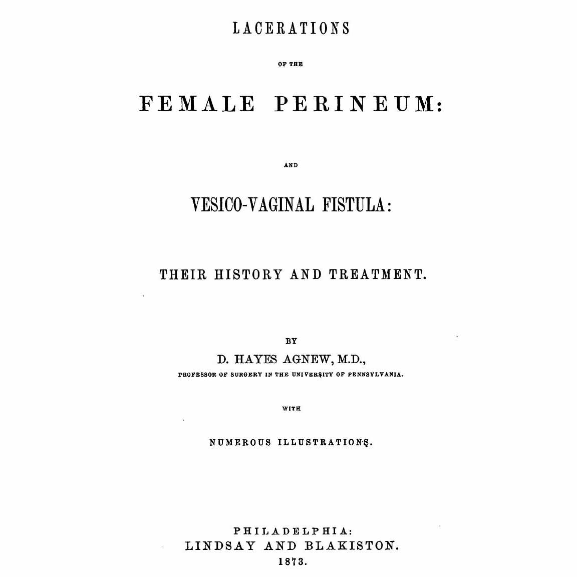 1873-AGNEW-Female-Perineum