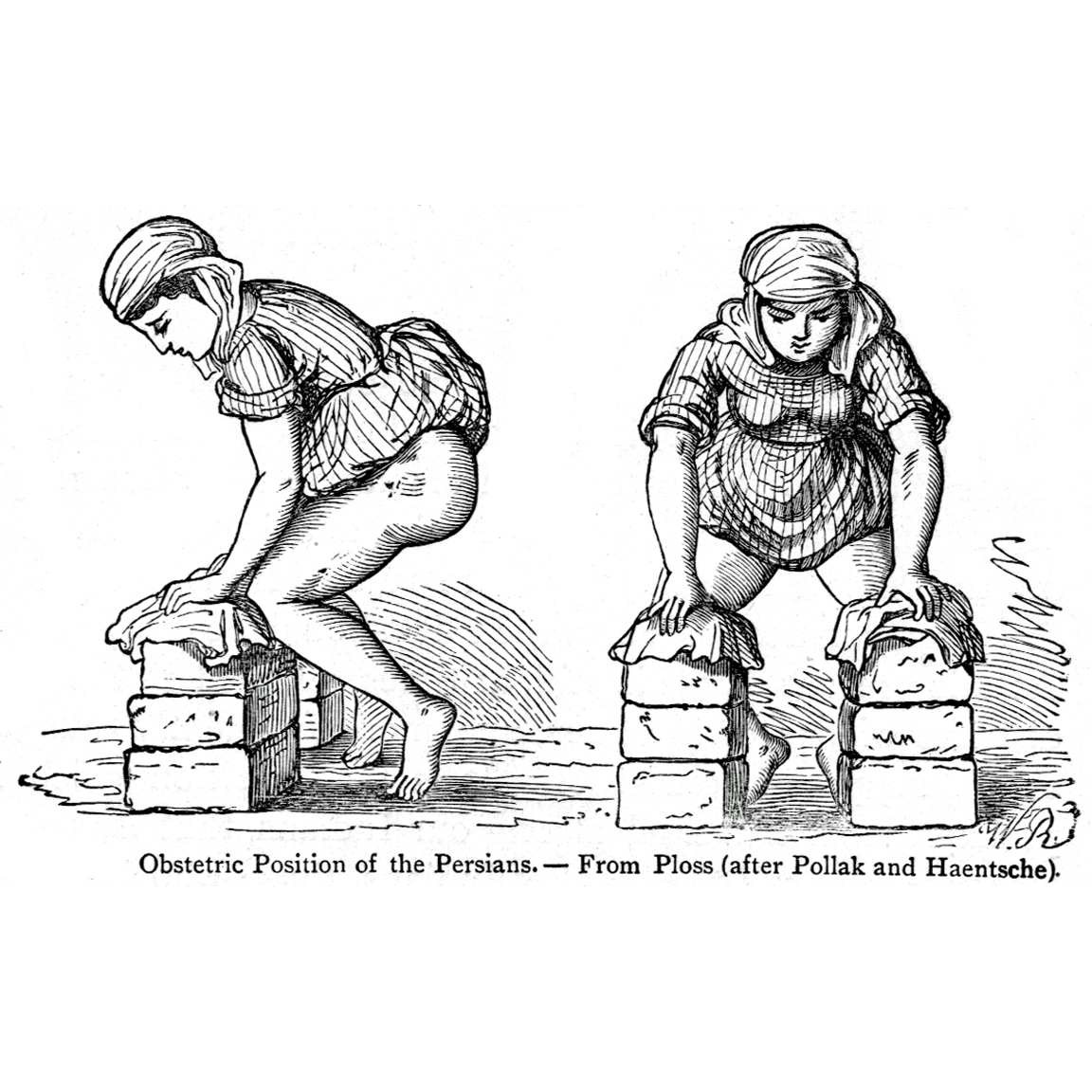Obstetric posture among the Persians