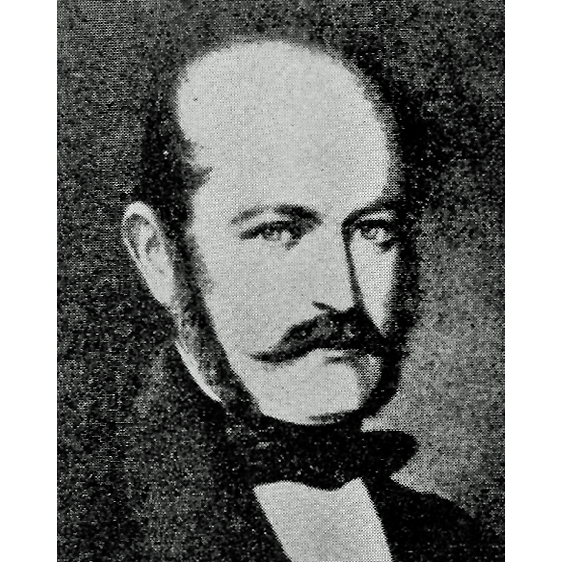 SEMMELWEISS-Ignaz-Philipp(1818-1865)