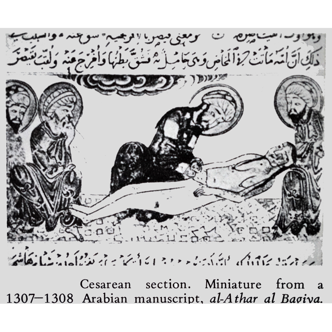 Arab Cesarean Section 1307