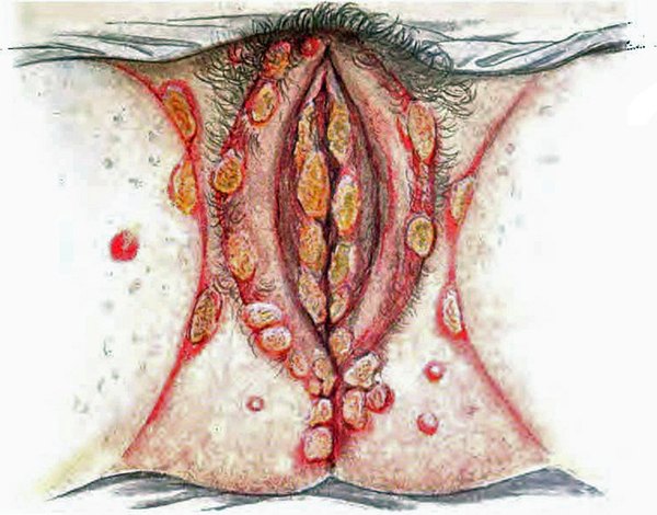 Vulva-Vagina