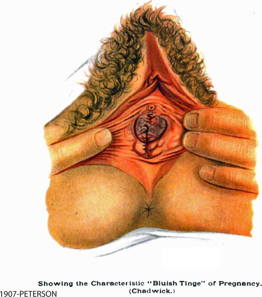 Diagnosis of Pregnancy