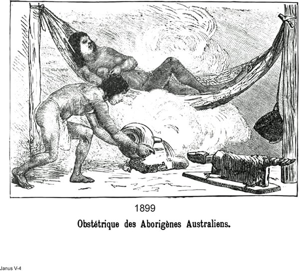 Australian Birth