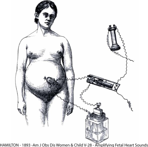 Fetal Assessment