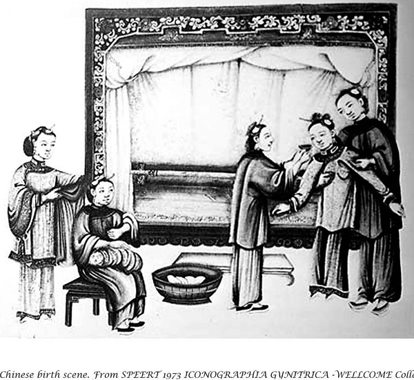 Chinese birth scene (Speert 1973)