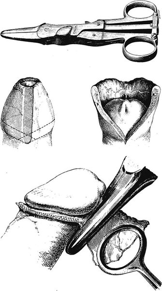 19th-C instruments