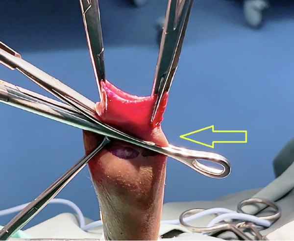 Modern clamp technique